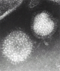 インフルエンザウィルス TEM像 ネガティブ染色凍結乾燥法