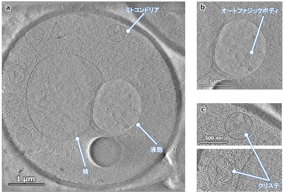Fig.6 酵母のTEM観察像
