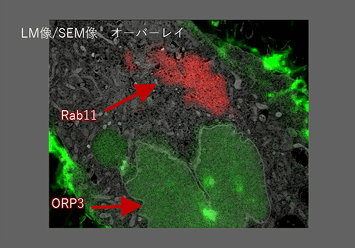 HeLa細胞中のエンドソームの観察