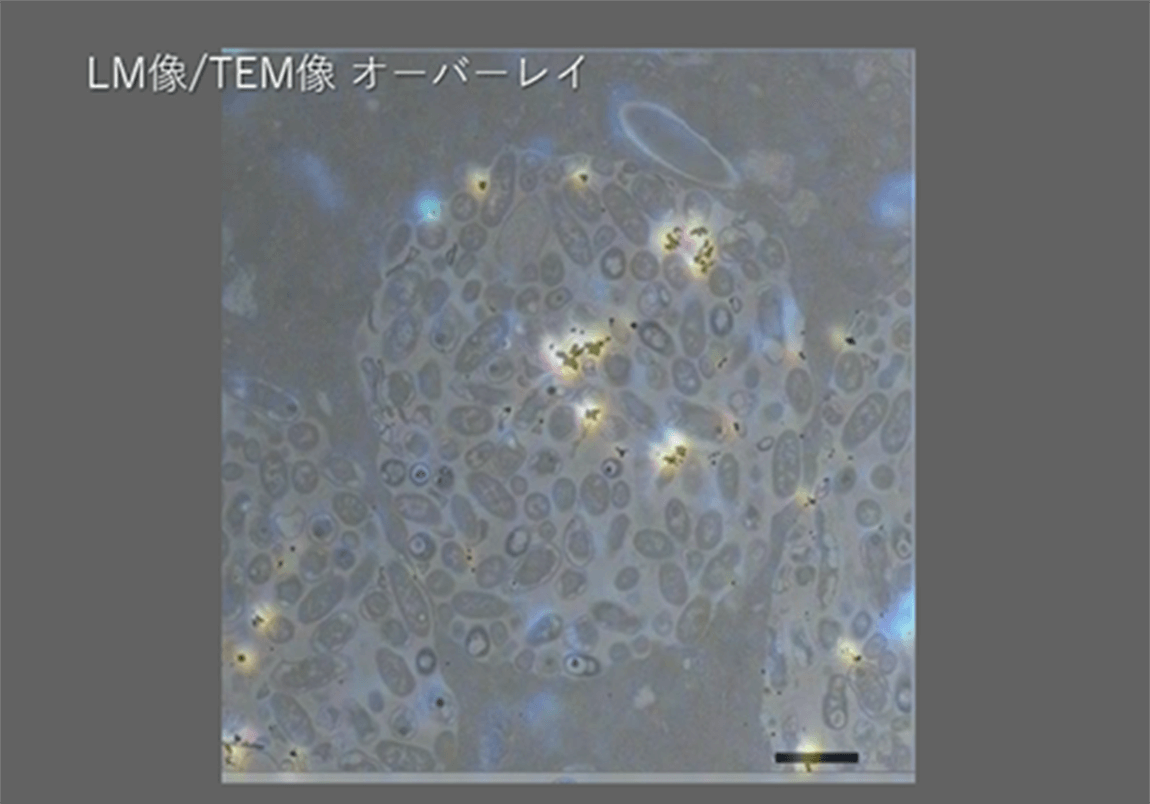 ゾウリムシに取り込まれた金粒子