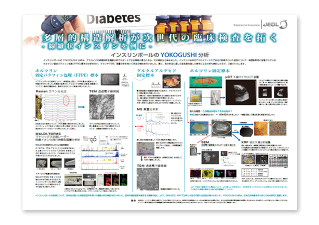 多多層的構造解析が次世代の臨床検査を拓く - 線維状インスリンを例に - ②