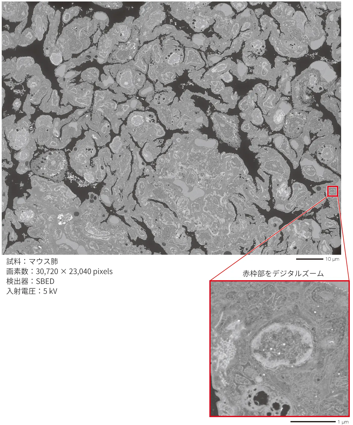 試料：マウス肺、画素数：30,720 × 23,040 pixels、検出器：SBED、入射電圧：5 kV