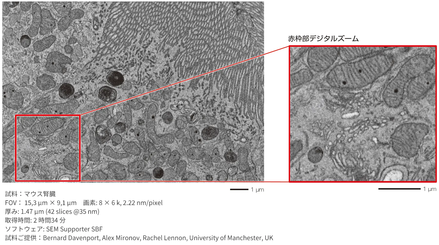 試料：マウス腎臓、FOV： 15,3 μm × 9,1 μm　画素: 8 × 6 k, 2.22 nm/pixel、厚み: 1.47 μm (42 slices @35 nm)、取得時間: 2 時間34 分、ソフトウェア: SEM Supporter SBF、試料ご提供：Bernard Davenport, Alex Mironov, Rachel Lennon, University of Manchester, UK