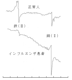 図5 健康人とインフルエンザ患者の信号