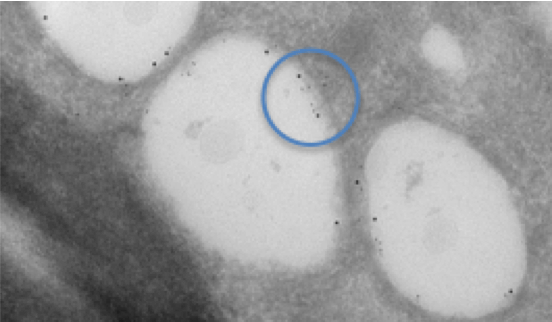 図1. C型肝炎ウイルスに感染した細胞中脂肪滴の免疫金標識法による二重標識。