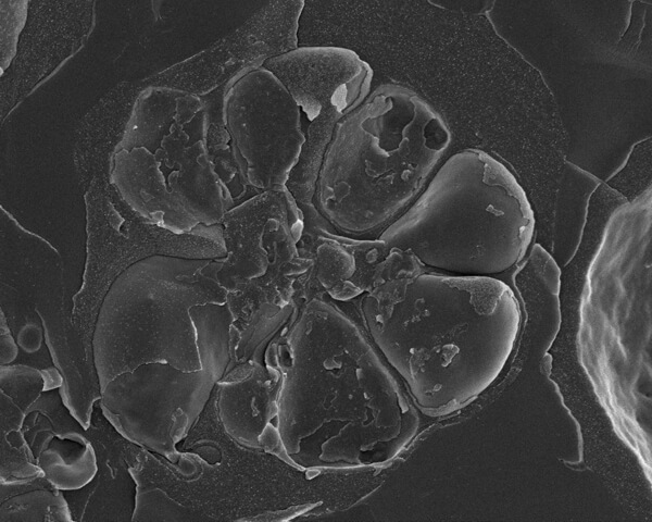 図2. 赤血球の内側で発達するマラリア寄生虫(熱帯熱マラリア原虫)。