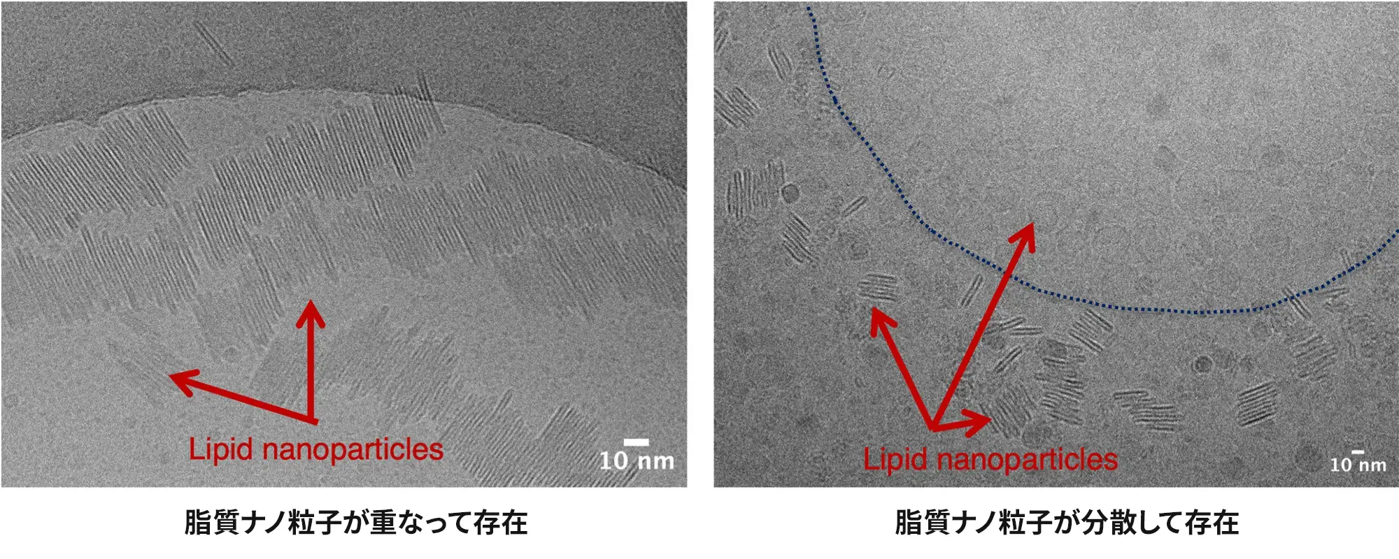 左：脂質ナノ粒子が重なって存在、右：脂質ナノ粒子が分散して存在