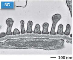 -10nm