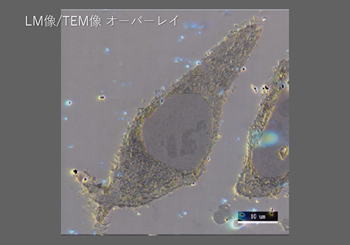 HeLa細胞中のTOM-20の局在観察
