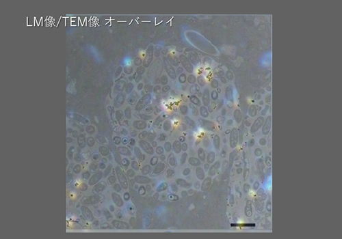 ゾウリムシに取り込まれた金粒子