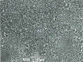 走査電子顕微鏡による手袋の表面写真
