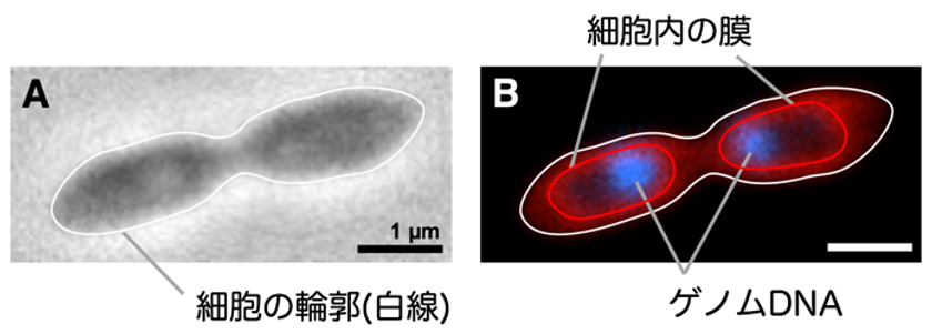 RT761株の細胞に局在するゲノムDNA