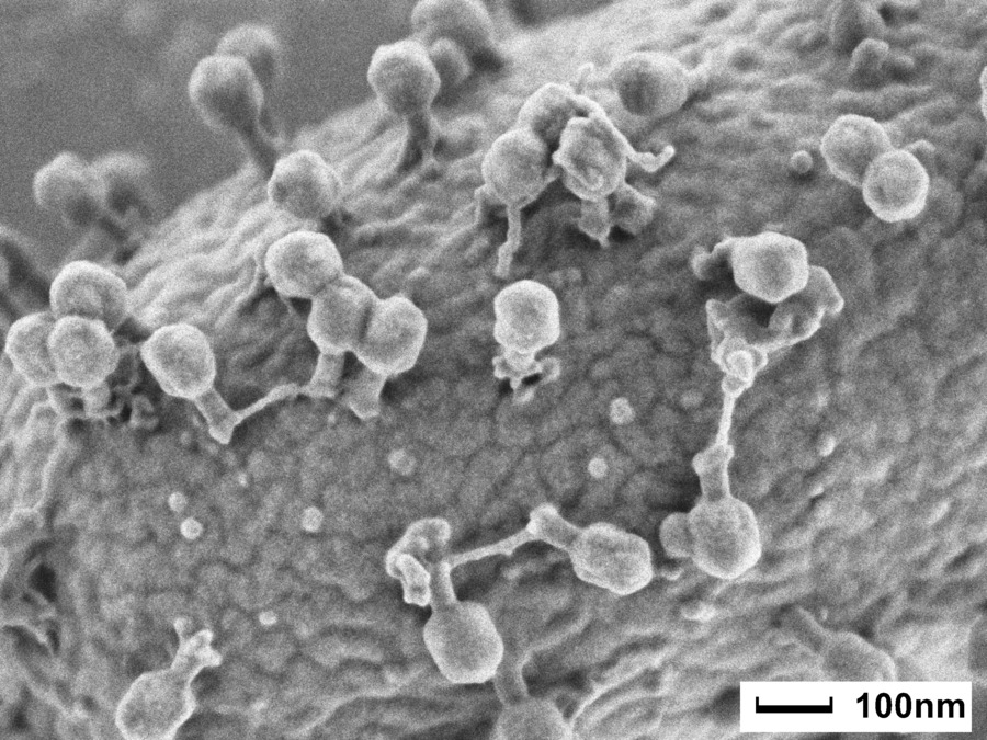 bacteriophage_t4_2.jpg