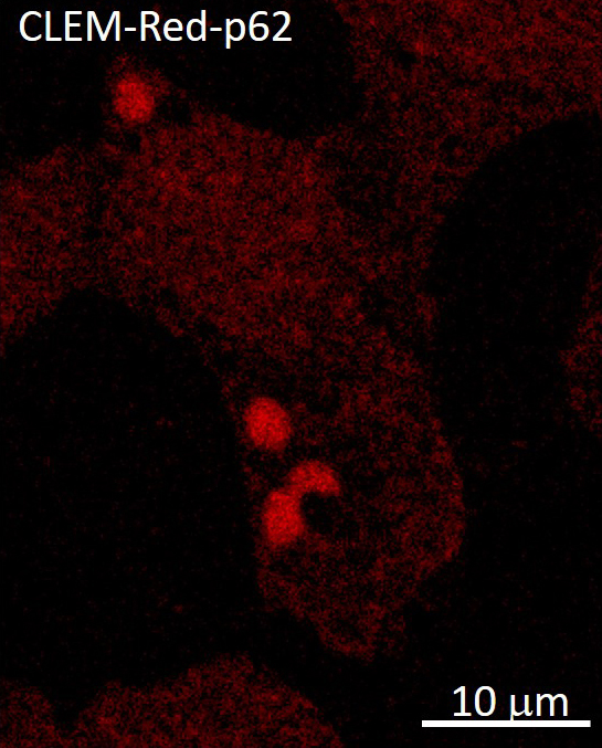 CLEM-Red-p62