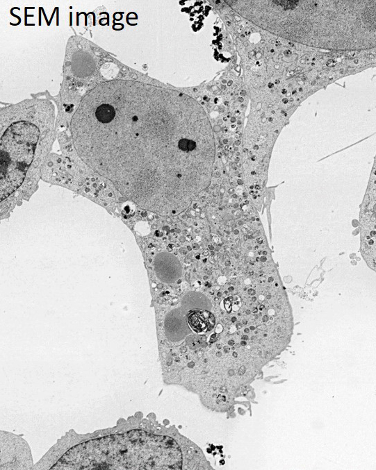 SEM image