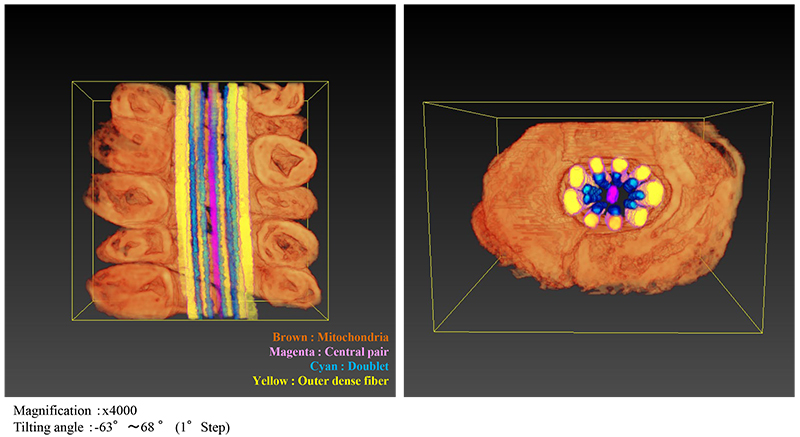 3D image (Volume Rendering) by Segmentation